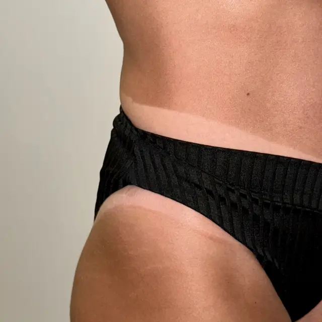 Spray Tanning by Face First Aesthetics and Acne Clinic in Carolina Beach, NC